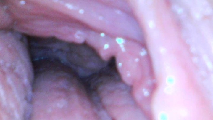 Milly17 Endoscope Play Part 1