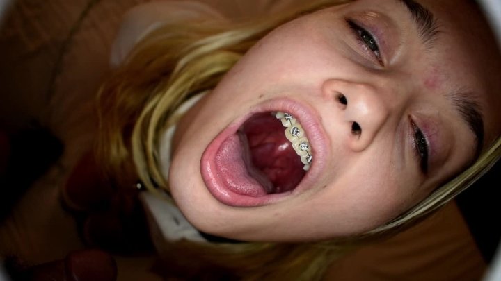 Submissive Teen Pov Teen Brace Face Pt2 Anastasia Knight